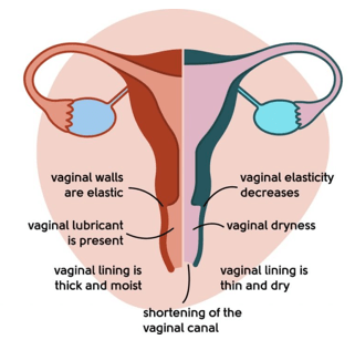 Cosmetic-Gynecology