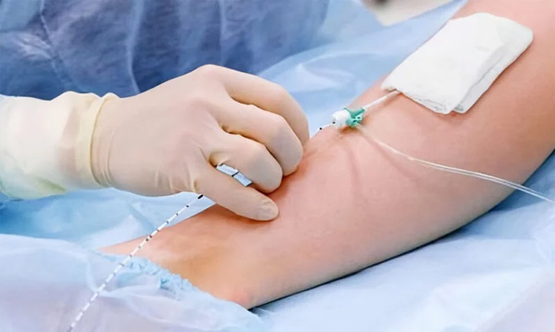 imgi_36_Endovenous-Laser-Treatment-01-800x479