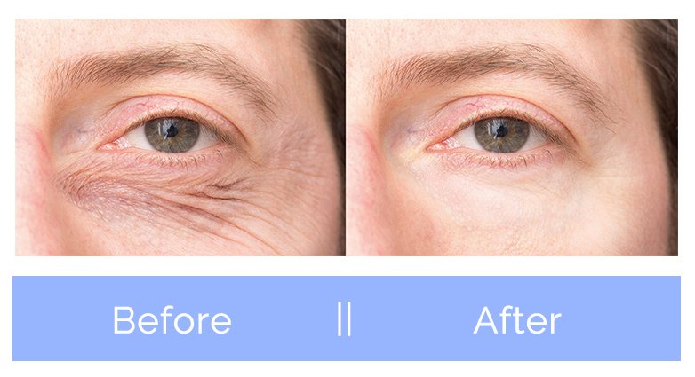 lipolysis4