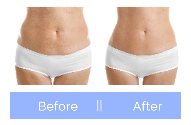 lipolysis6
