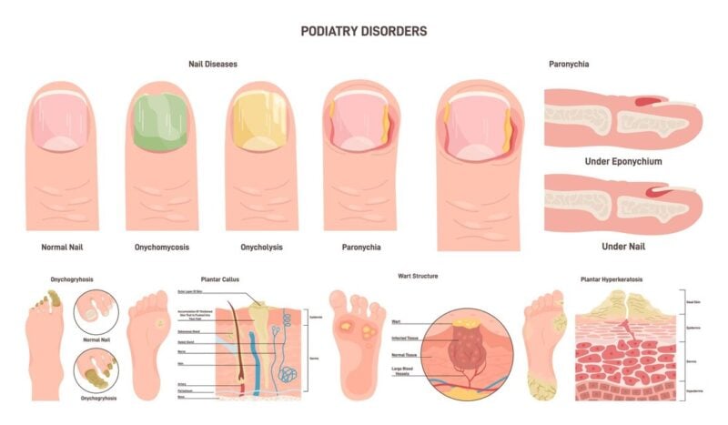 podiatry-disorders-800x467